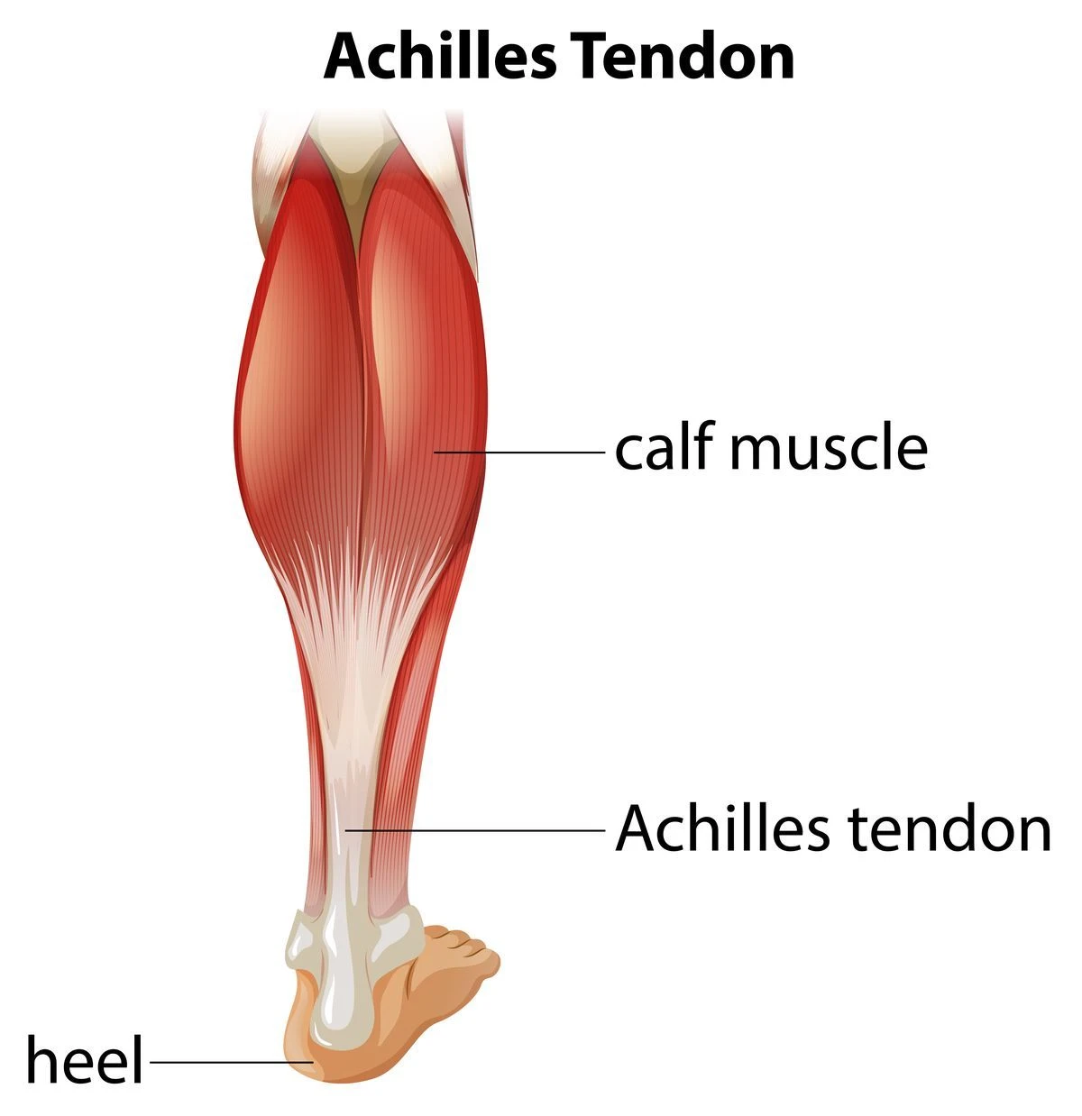 Achilles-ín fájdalom mckenzie terápia