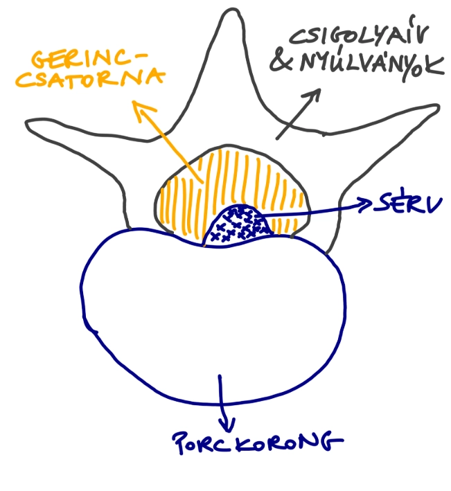Porckorongsérv-gerincsérv: nem a méret a lényeg